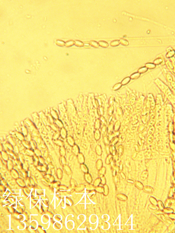 子囊及子囊孢子 真菌玻片标本