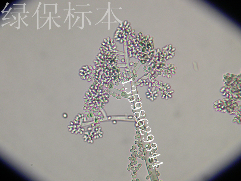 详细说明:         有病原图指示的玻片标本         枯萎菌厚垣孢子