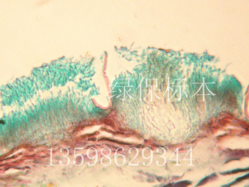 苹果炭疽病分生孢子盘及分生孢子