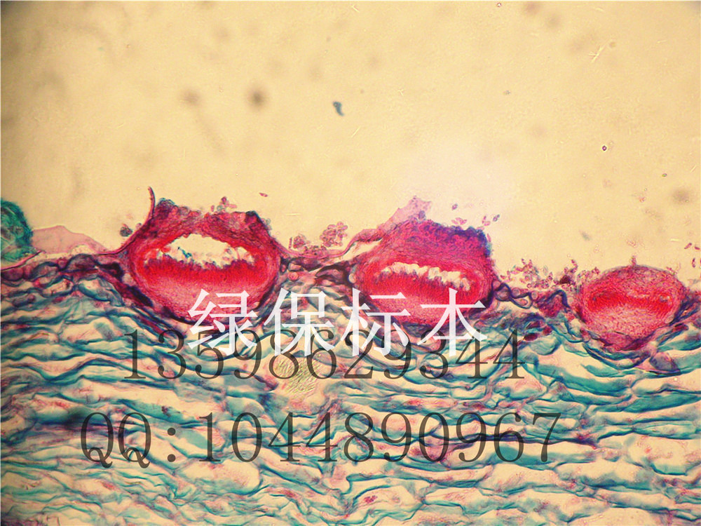 葡萄白腐病 盾壳霉属