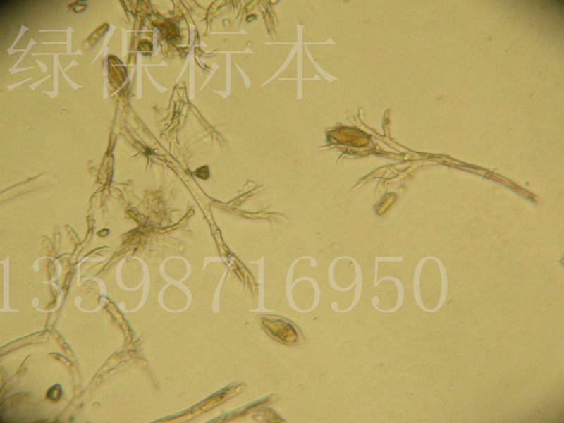 蔬菜病害标本 葱霜霉病菌孢囊梗及孢子囊