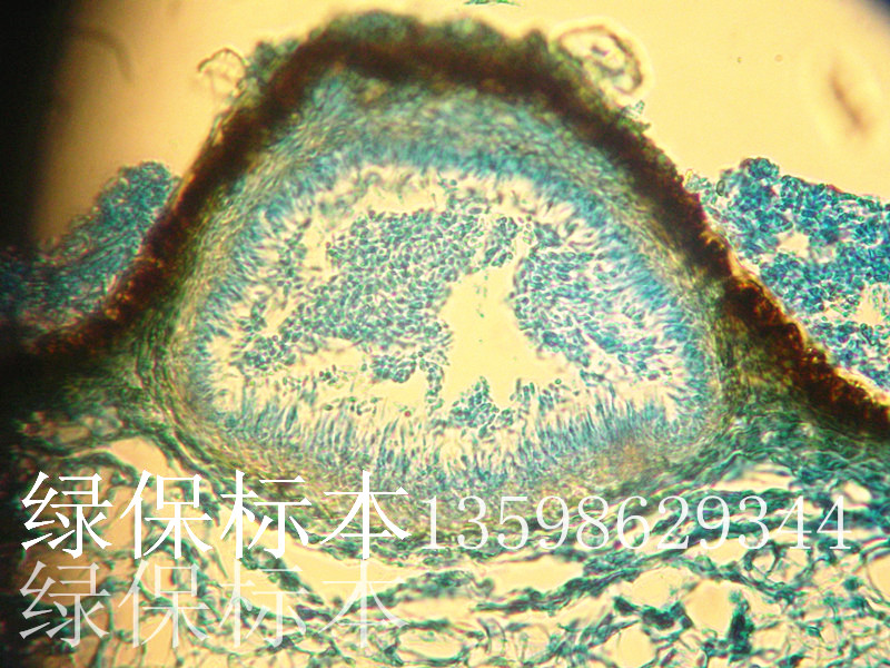 植物病理学标本茄褐纹病分生孢子器