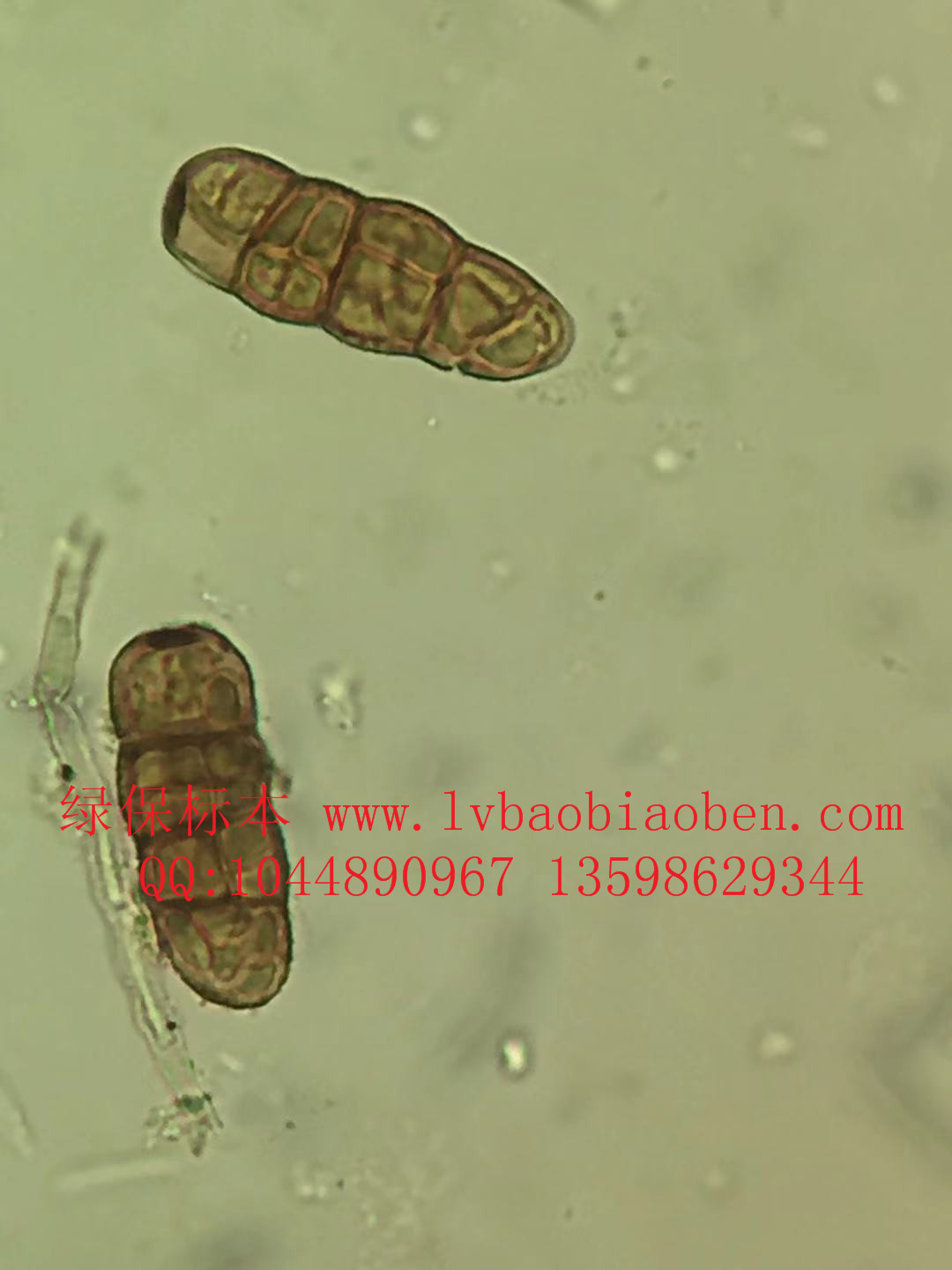 葱叶枯病菌分生孢子 蔬菜病虫害玻片标本