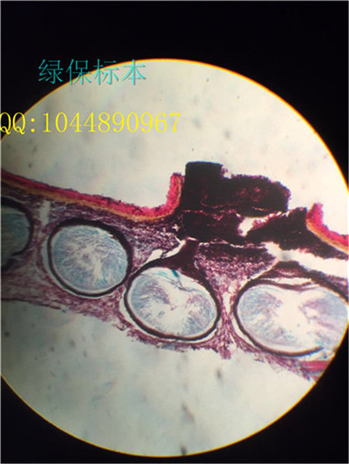 苹果腐烂病子囊壳 果树病虫害病原物切片标本