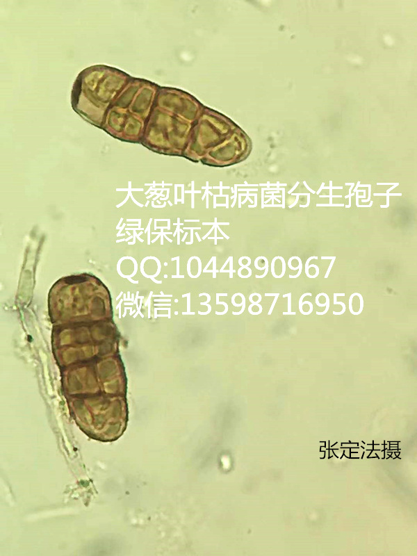 大葱叶枯病菌分生孢子 蔬菜病害虫害标本