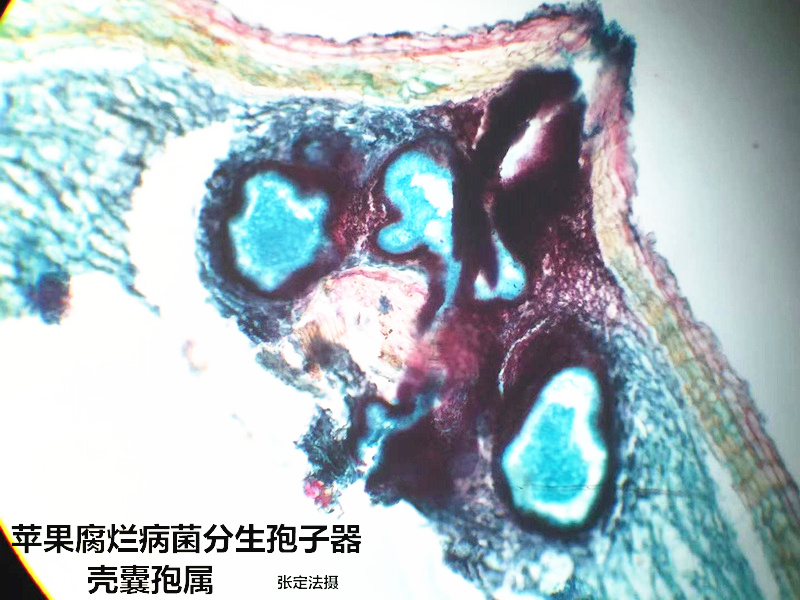 壳囊孢属 苹果腐烂病菌分生孢子器 果树病害玻片标本