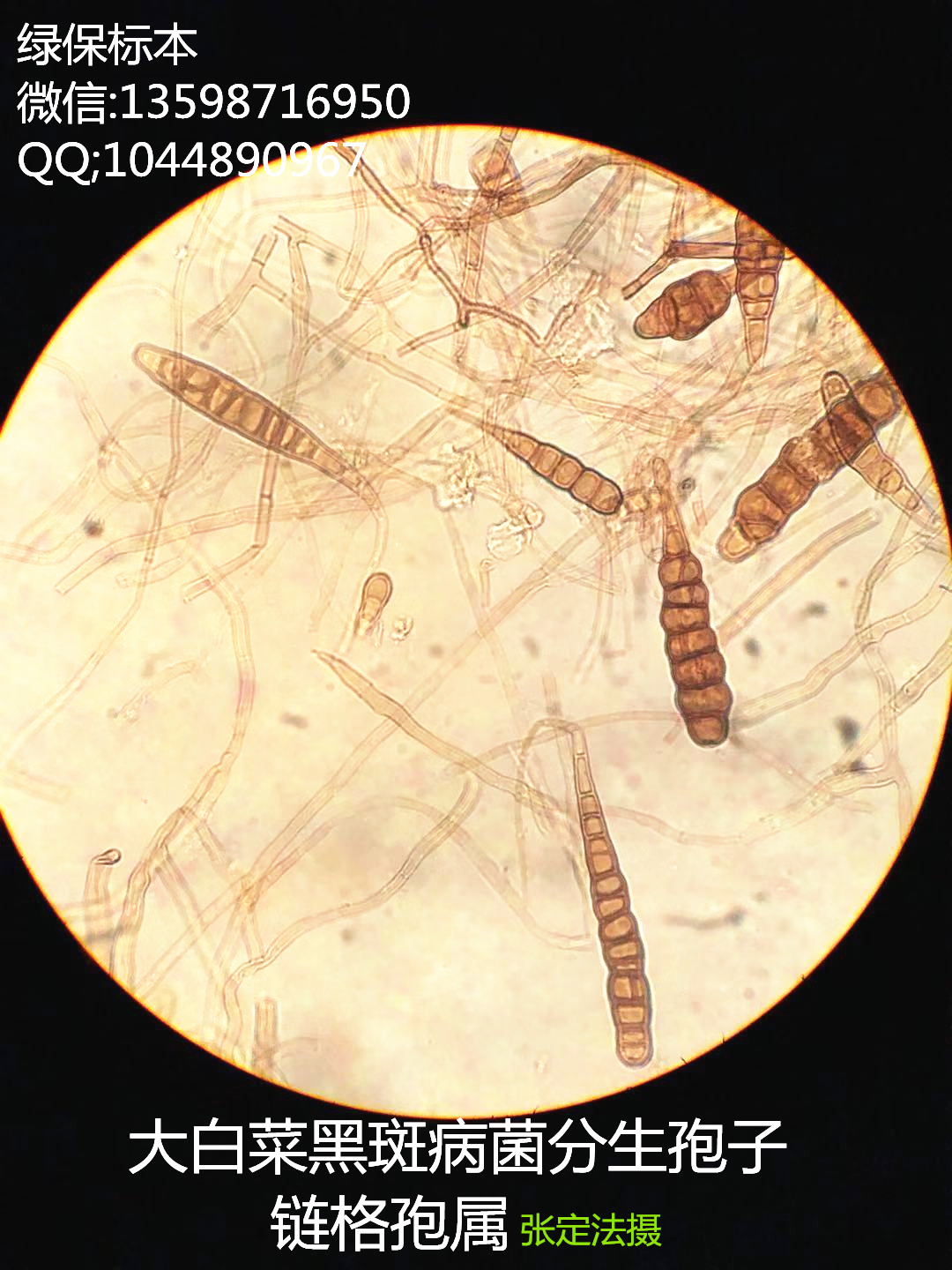 链格孢属 大葱紫斑病菌玻片标本