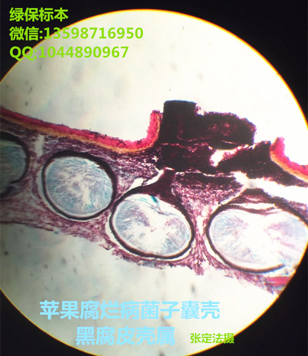 黑腐皮壳属 苹果腐烂病菌子囊壳切片标本