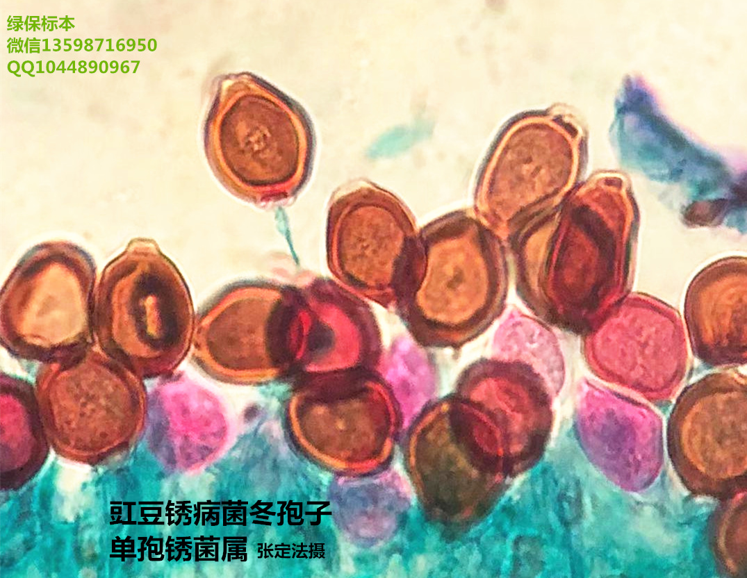 科学网—荧光显微镜下的白粉菌 - 李雄的博文