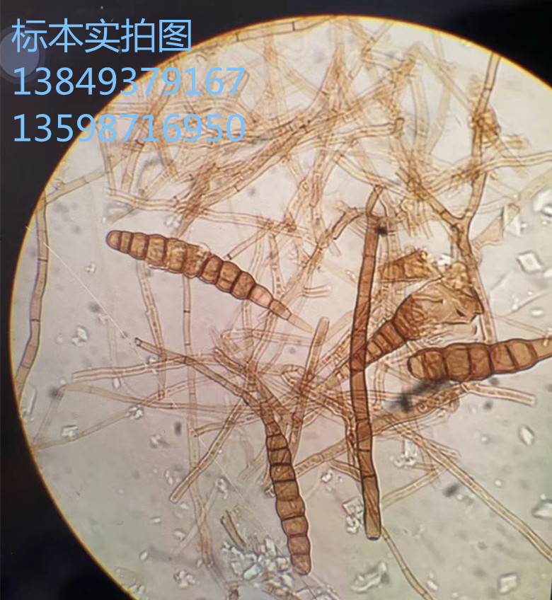 葱紫斑病菌植物作物果树蔬菜病虫害玻片标本