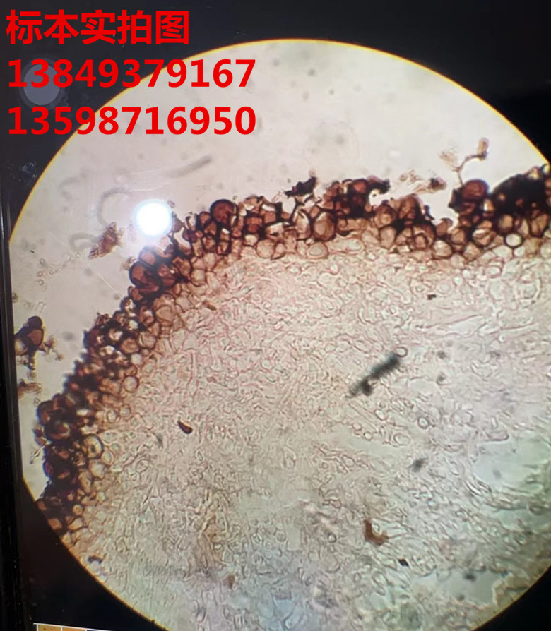 菌核切片 植物作物果树蔬菜病虫害玻片标本
