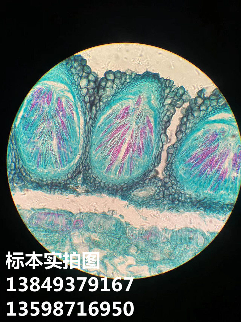 小麦赤霉病菌植物病虫害玻片标本