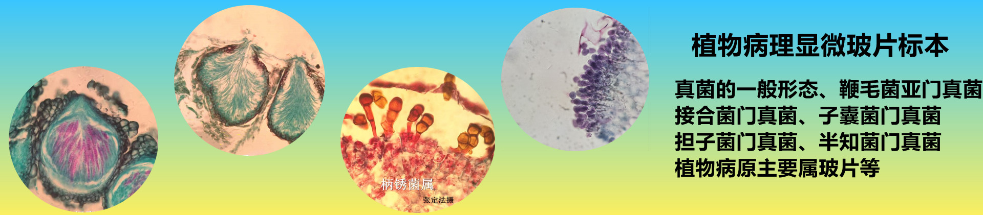 绿保标本|植物病害虫害标本厂家|植物病害玻片切片标本生产厂家|植物病虫害 病害 害虫标本|大田粮食作物 农作物病害 虫害 病虫害标本|水稻 小麦 玉米 大豆 花生病虫害 病害 害虫标本|果树 蔬菜 园林 森林病虫害 病害 害虫标本|农作物病害玻片切片标本|美国白蛾生活史|农作物害虫标本|农作物病虫害标本|果树 蔬菜病虫害 病害 虫害标本|园林 园艺病虫害 病害 害虫标本|森林 林业病虫害 害虫标本|植物病虫害标本|小麦病害 害虫 病虫害标本|水稻病虫害 病害 虫害标本|玉米病虫害标本|杂粮病害 病虫害 害虫标本|作物病害玻片切片标本|农田杂草标本|观赏植物 花卉病虫害标本|棉花病虫害标本|显微镜玻片标本|资源昆虫标本|锈病 分生孢子玻片切片标本|农业昆虫生活史标本|粮食作物病虫害标本|经济作物病虫害标本|现代农艺技术病虫害标本|农业有害生物标本|现代种植业病虫害标本|花卉病虫害标本|食叶类害虫标本|蛀干类害虫标本|地下害虫标本|普通植物病理学玻片标本|普通昆虫学标本|农业昆虫学盒装标本|小麦锈病白粉病赤霉病 玉米大小斑病 稻瘟病 小麦蚜虫 玉米螟 棉铃虫 草地贪夜蛾 粘虫 盲蝽象标本 中考生物实验显微镜观察永久切片-新乡市绿保标本厂