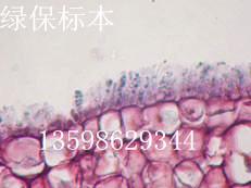 果树病害标本 桃缩叶病外子囊切片