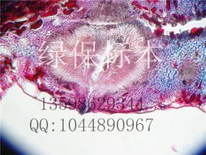 杏疔病性子器 果树病害切片标本