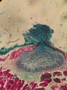 梨锈病性子器切片植物作物果树蔬菜病害害虫昆虫显微镜玻片标本