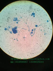 盘梗霜霉装片植物作物果树蔬菜虫害病害害虫玻片装片切片标本