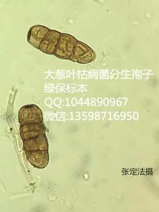 大葱叶枯病菌分生孢子 蔬菜病害虫害标本