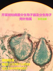 壳针孢属 芹菜斑枯病菌分生孢子器及分生孢子