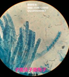 子囊及子囊孢子 普通植物病理学玻片标本