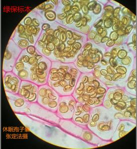 玉米褐斑病菌休眠孢子囊  张定法摄