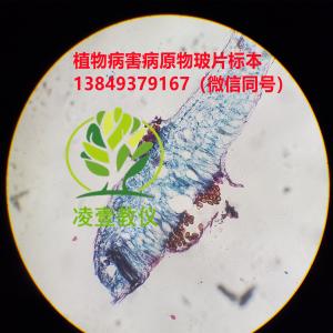 菜豆锈病（冬孢子）玻片标本