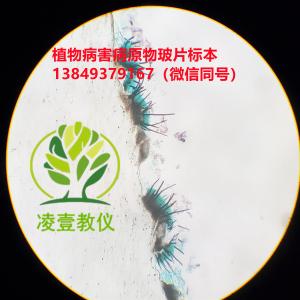 刺盘孢属（辣椒炭疽病）玻片标本