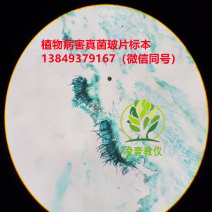 大豆炭疽病（分生孢子盘）玻片标本  生物切片标本