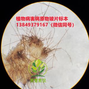 番茄褐斑病玻片标本