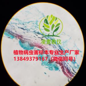 盘二孢属（苹果褐斑病）玻片标本