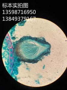 赤霉菌属子囊壳植物病虫害玻片标本