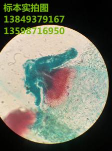 梨锈病性子器及孢子堆植物作物果树蔬菜病虫害玻片标本